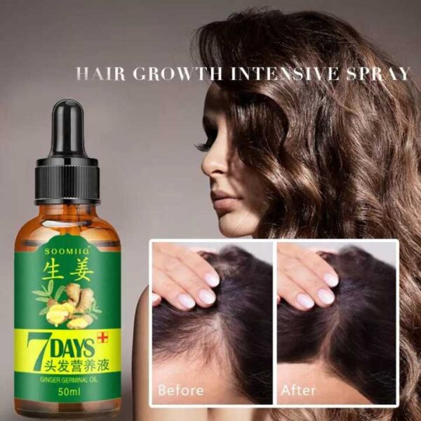 30ML Natural Hair Growth Serum: