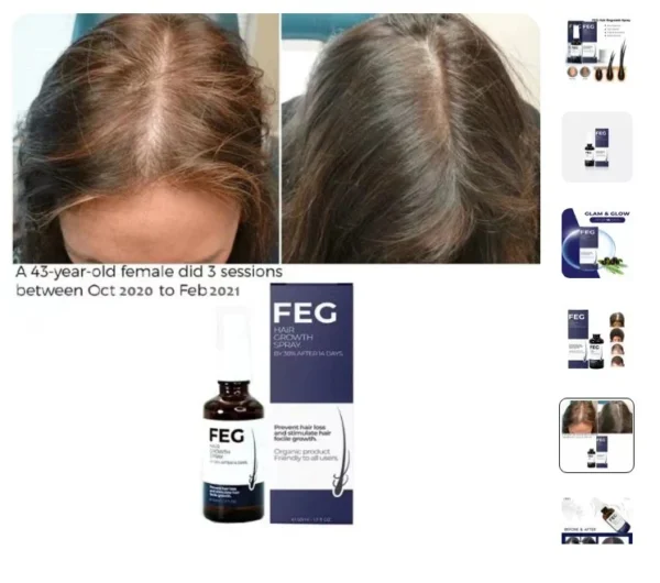 Hair Growth Spray - Image 3